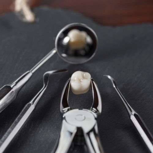 Tooth extraction glenview IL