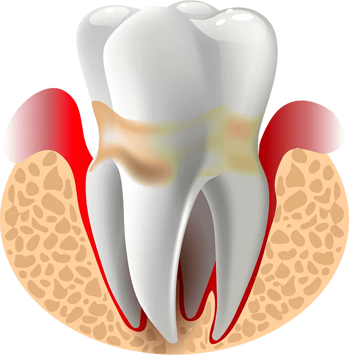 Surgical dentistry Glenview IL