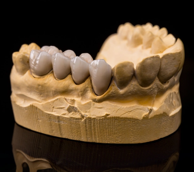 Dental Crown Lengthening