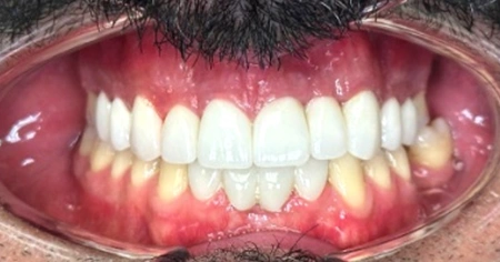 multi-speciality-case-after-stage-3