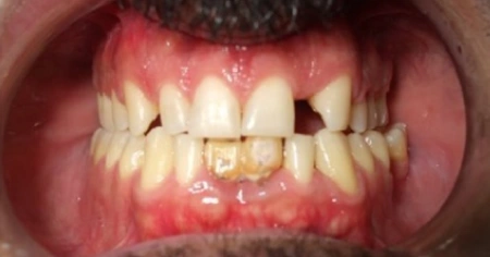 multi-speciality-case-before-Stage-1