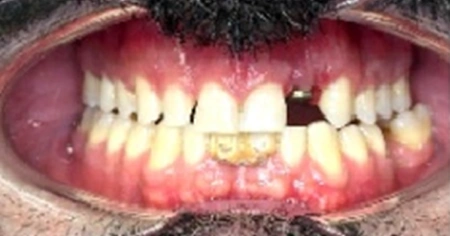 multi-speciality-case-before-stage-2